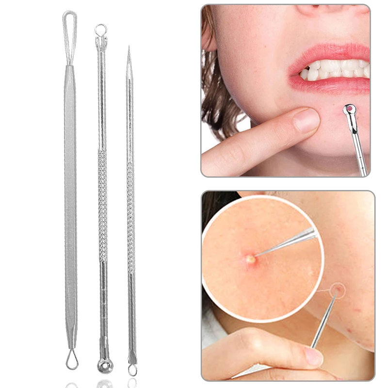 

3Pcs/set Stainless steel Acne Needle Pimples Antibacterial Blackhead Pimple Spot Comedone Remover Extractor Blackhead Tweezers