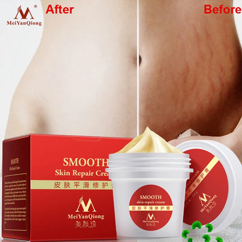 

MeiyanQiong Smooth Skin Cream For Stretch Marks Scar Removal To Maternity Skin Repair Body Cream Remove Scar Care Postpartum
