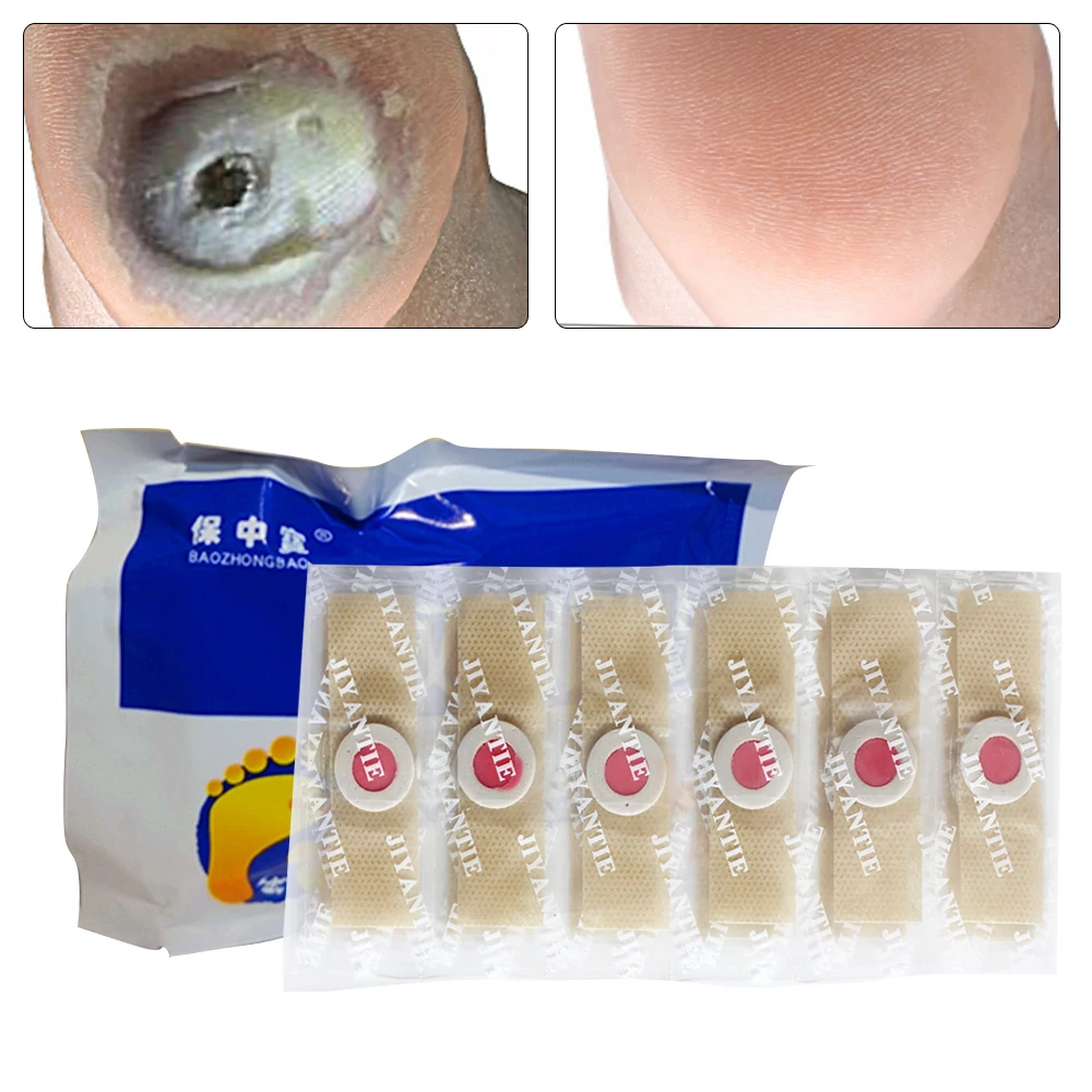 

6/12pcs Medical Plaster Calluses Plantar Pad Foot Corn Removal Patches Pads Foot Care Thorn Plaster Patches For Relieving Pain