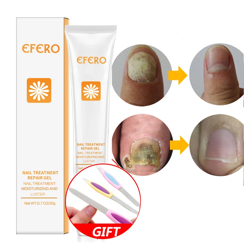 EFERO Nail Repair Essence Serum Toe Nail Fungus Onychomycosis Removal Treatment Nail Care Essence Anti Fungal Nails Repair Cream