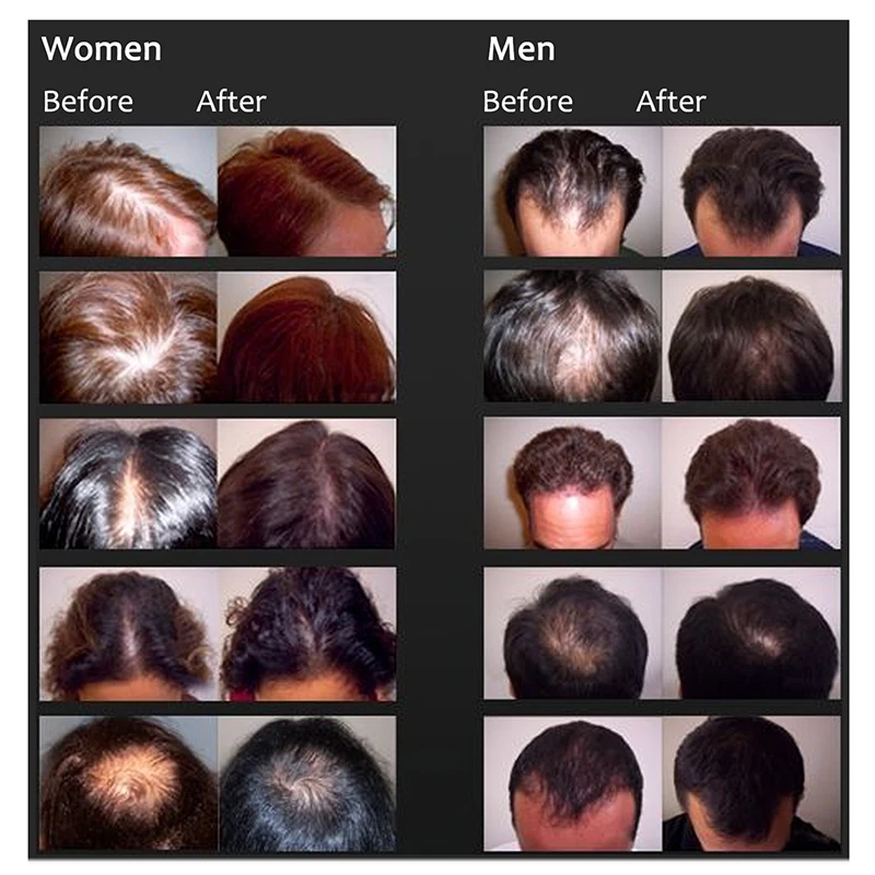 1 шт., 30 мл, эссенция женьшеня, макияж для волос, уход, лечение, для мужчин и женщин, выпадение волос, ускоренный рост волос, сыворотка Maquiagem
