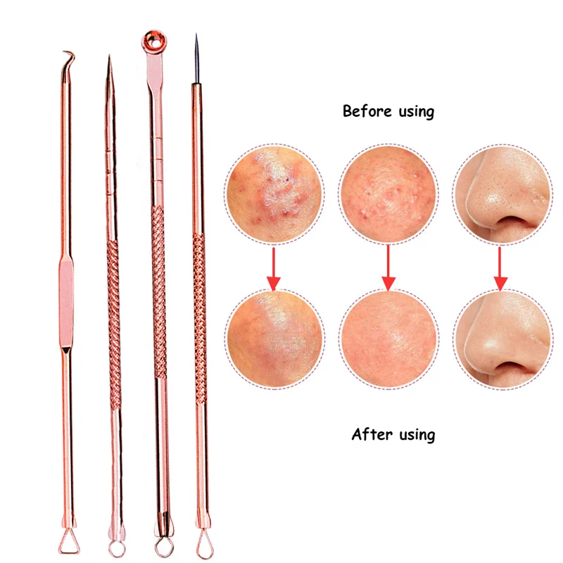 2/3/4/5 шт для удаления черных точек прыщей Угорь инструмент ложка для чистки лица Уход за кожей пинцеты для прыщей комедонов инструмент для удаления прыщей игла