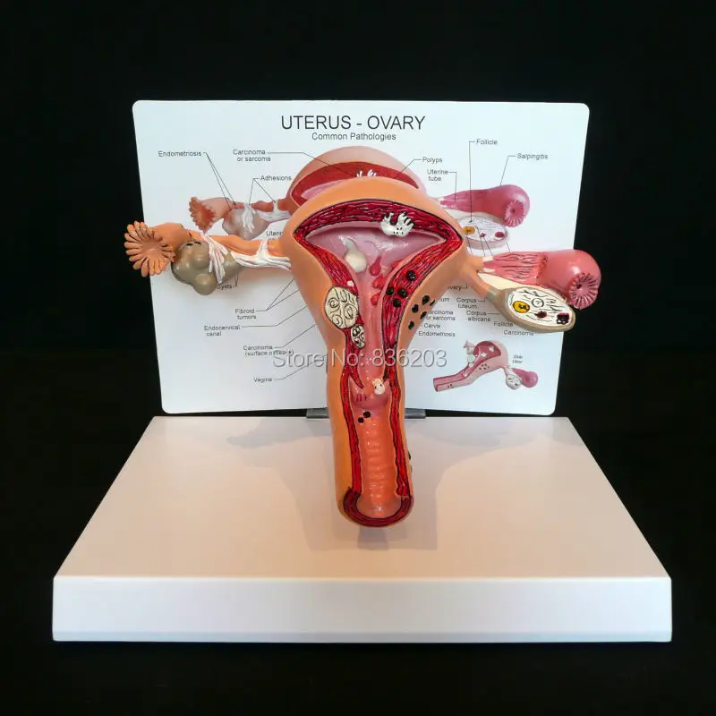 Патологическая матка и яичник анатомическая модель в травме анатомический Скелет стоматологический анатомический теневой медицинский тренировочный манекен
