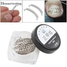 Ногти для ног "францзуский маникюр" коррекция педикюра провода Инструмент Уход за ногтями провода вросшие ногти фиксаж Ноготь на пальце ноги восстановить, забота о ногах, ногти для ног "францзуский маникюр" инструмент коррекции одометра