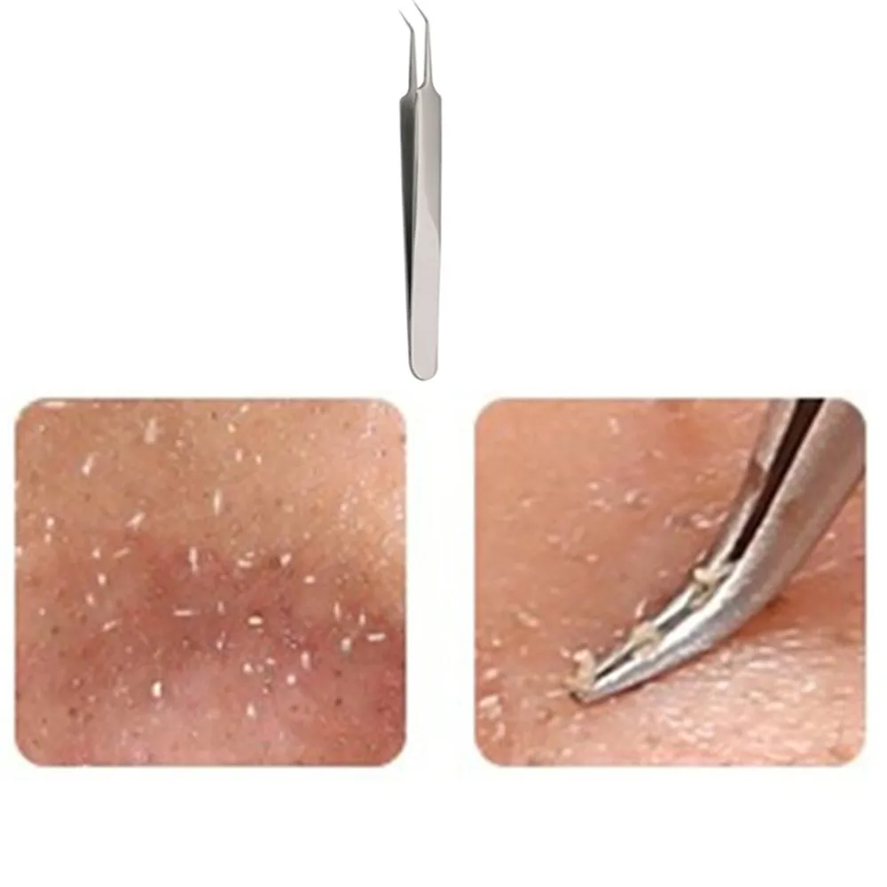 Useful Stainless steel Straight Bend Curved Blackhead Acne Clip Tweezer Pimple Comedone Remover Kit Face Cleaner Sadoun.com