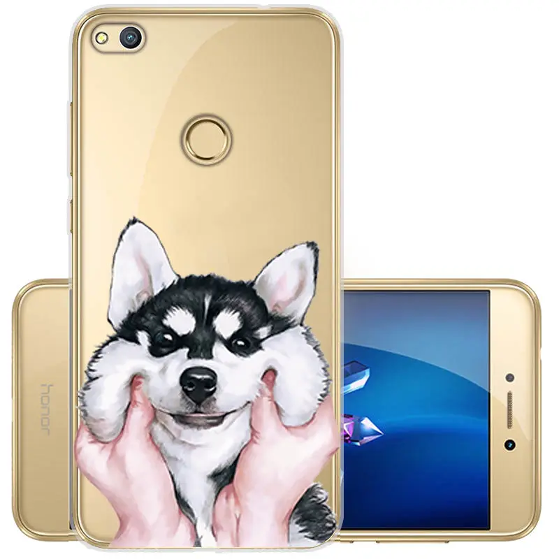 Painted Soft TPU Cover for Huawei P8 P9 Lite 2017 Clear Silicone Case Y5 Y6 2017 P Smart Honor 10 9 8X 9 lite Protective Fundas  (4)