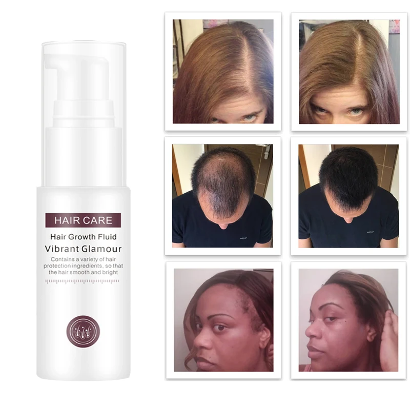 

30ml Hair Growth Serum Essence Spray for Women and Men Anti Prevent Hair Loss alopecia Liquid Damaged Hair Growth Liquid