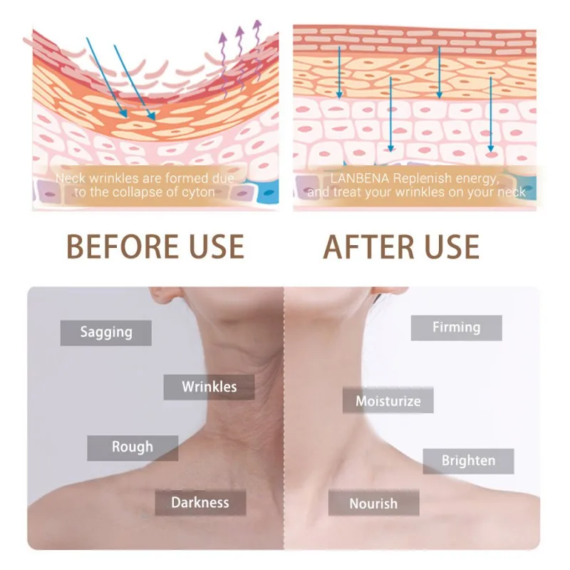 Máscara hidratante para el cuello para el cuidado del cuello antiarrugas hidratante Reduce las líneas finas para aliviar el cuidado de la piel del cuello