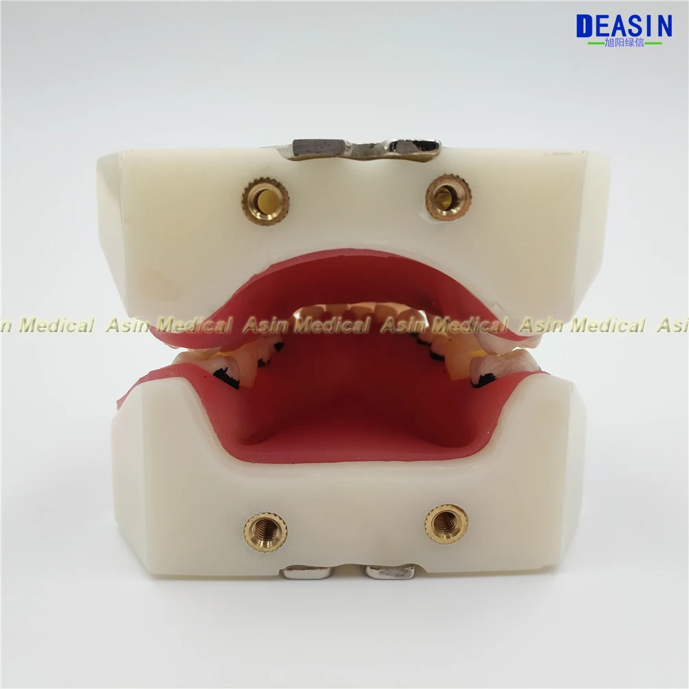 Modelo de Aprendizagem Modelo de Doença Deasin Novo Dentista Periodontal Dente - Modelo Médico 3 Clareamento dos dentes