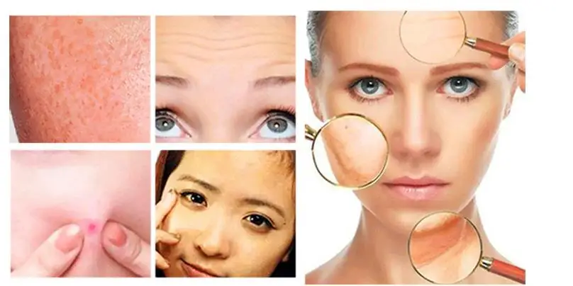 Escova de Limpeza Máquina de Limpeza Esfoliante da Pele Lavagem do Corpo Rosto Massageador Facial Peeling Elétrica 10in1 10 High Quality Beleza e saúde