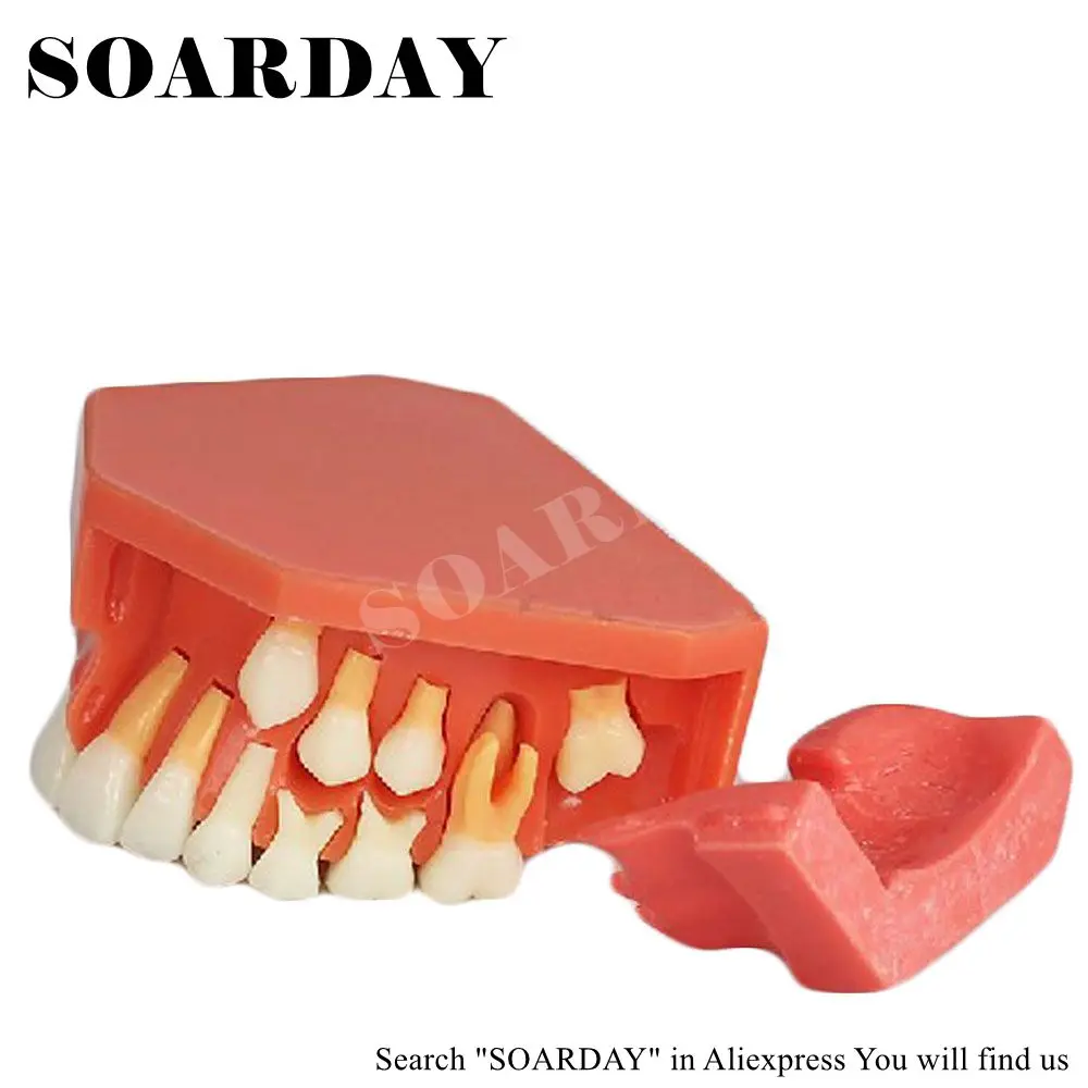 Dentural Development Model (2)_