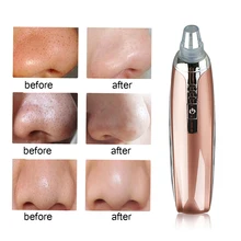 Вакуумный отсос для угрей алмазное удаление дермабразии для постугревых рубцов пилинг для пор очищающее лицо кожи лица ухаживающее косметологическое оборудование инструмент