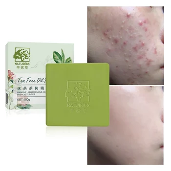 

Tea Tree EXtract Oil Soap Moisturizing Control Oil Handmade Soap Anti-Acne Shrinking Pores Remove Pimples Mites 100g