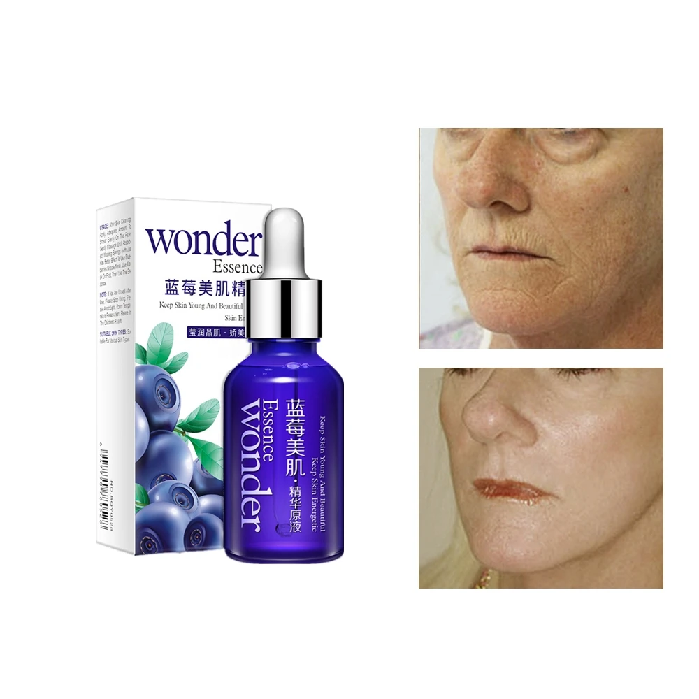 Floresan atha концентрат для лица лифтинг-эффект с гиалуроновой кислотой. витэкс / крем для лица, шеи и декольте ночной гиалурон lift. Tete cosmeceutical гиалуроновая кислота 100% 10мл. гиалуроновая кислота лифтинг эффект. уколы гиалуроновой кислоты до и после.