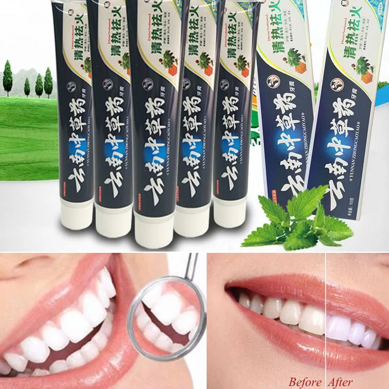 Зубная паста Юньнань байяо 180 отбеливающая зубная паста|yunnan baiyao toothpaste|black