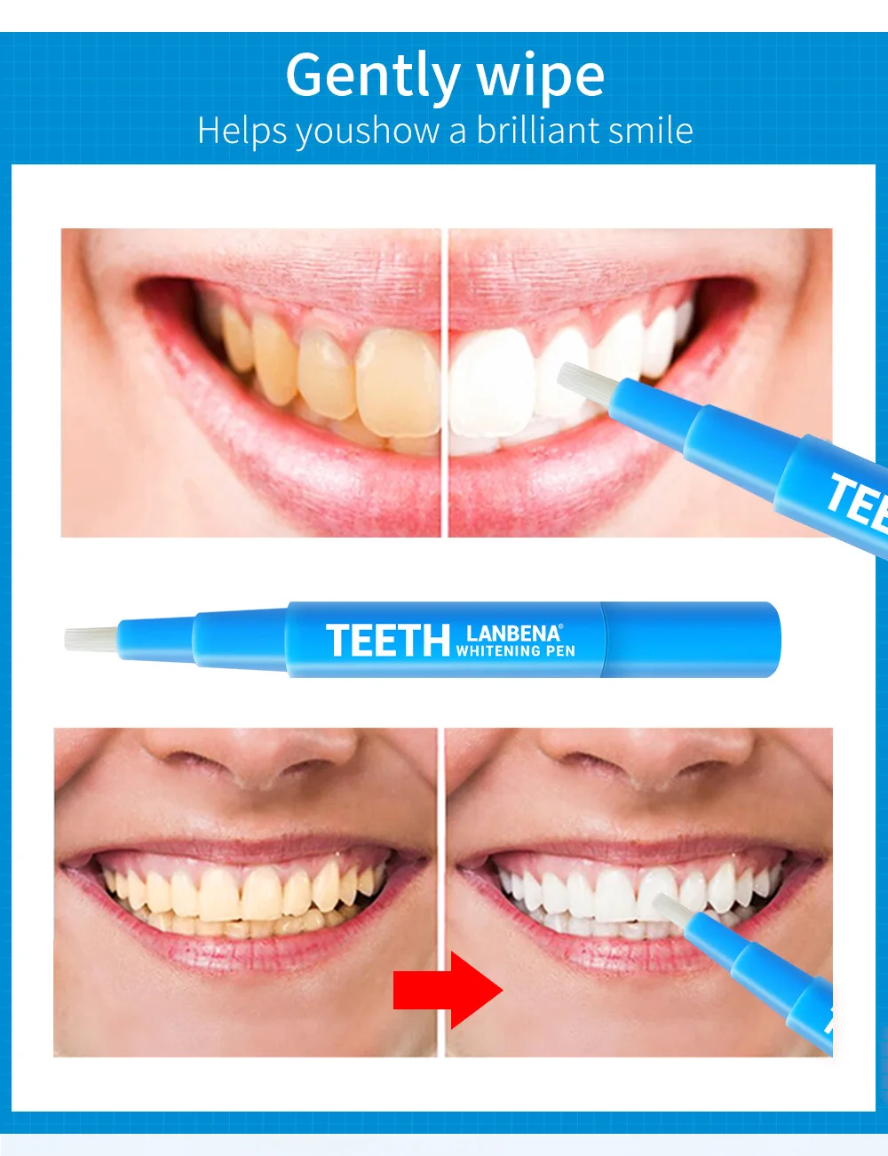 LANBENA, 3 мл, отбеливающая ручка для зубов, гелевая, безопасная, быстро отбеливающая, домашняя, отбеливающая ручка для зубов, набор для отбеливания зубов, TSLM2