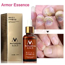 Для ухода за ногтями, сущность мощных средства для ухода за ногтями, забота о ногах, сущность дизайна ногтей Отбеливание стопы ног удаление грибка Гель-лак для ногтей, SK88