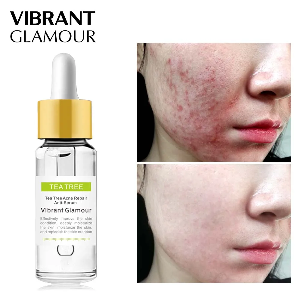 

VIBRANT GLAMOUR Acne Repair Face Serum Tea Tree Extract Liquid Essence Shrink Pores Acne Treatment Oil control Facial Skin Care