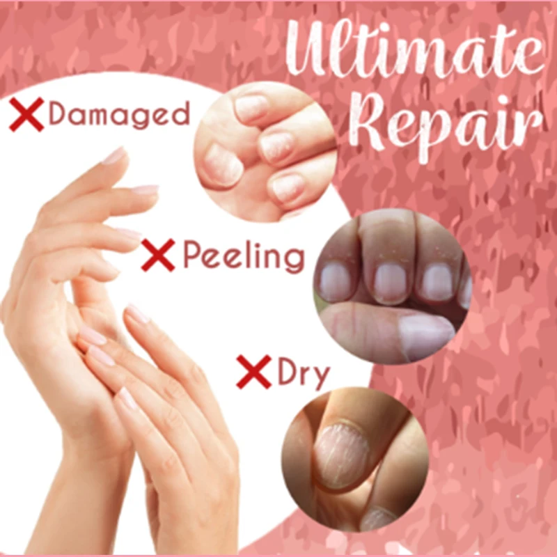 Ultimate Repair натуральные ингредиенты увлажняет и смягчает парафиновый воск для ногтей с розами грибковое лечение воском для ухода за ногтями