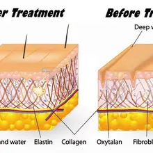 Гликолевая кислота 70% обновления peel Exfoliator чистая AHA Косметическая сила