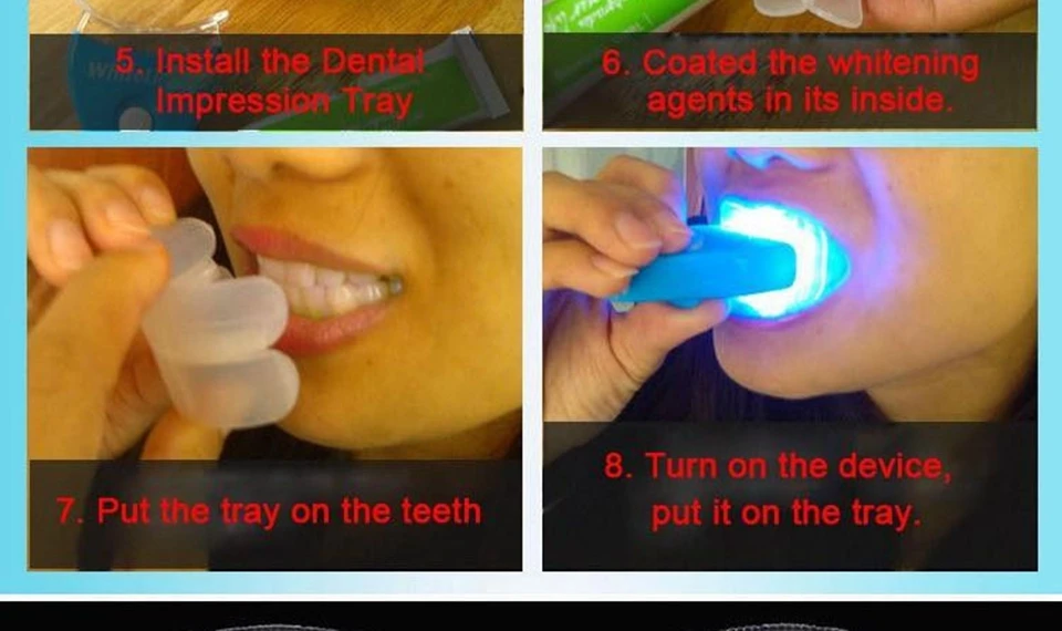 teeth-whitening_03
