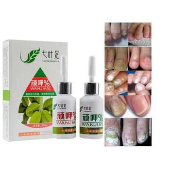 

Nail Treatment Essence Nail and Foot Whitening Toe Nail Fungus Removal Whitening Onychomyco Feet Care Nail Gel Tools