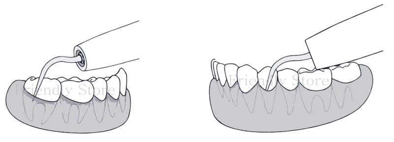 Dentista Produtos 3 шт. GK5 многофункциональным Scaler СОВЕТ Для KAVO и SIRONA воздуха скейлер Для удаления зубного камня и бактериальных lasue