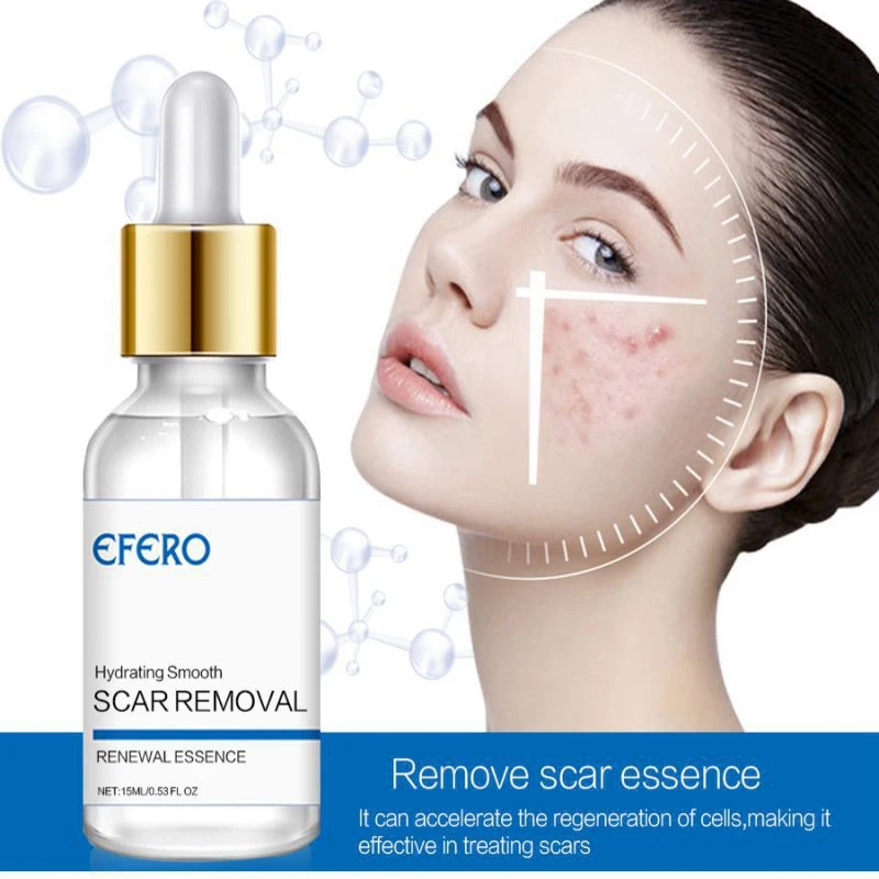 Scar Removal Liquid Remove Scar Acne Mark Stretch Marks Scar Repair