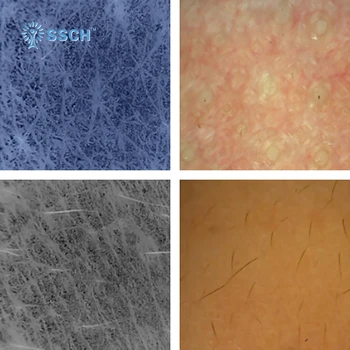 

Skin care Cosmetics Distributors Portable Skin Analyzer Machine , skin scope