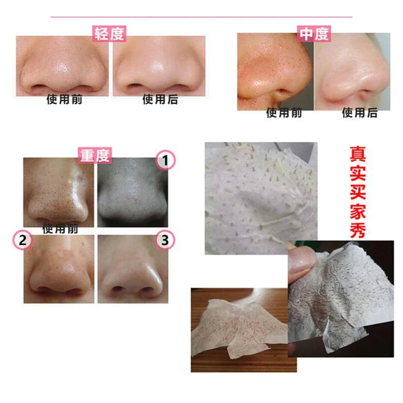 QQ20180524151942
