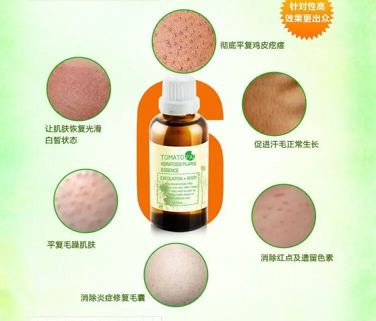 lotion that removes dead skin