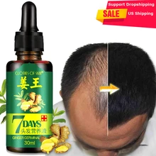 30 мл эссенция для роста волос, сыворотка, быстрое мощное эфирное масло для волос, жидкое лечение, продукты для предотвращения выпадения волос, уход за волосами