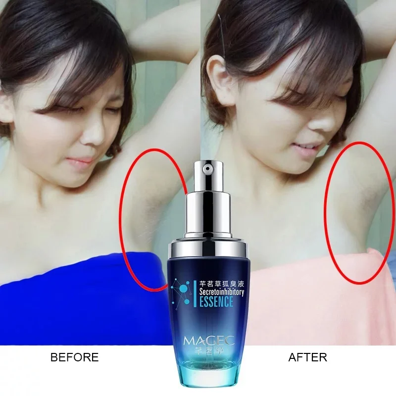 Уход за кожей Дезодоранты спрей уменьшает запах пота подмышек антиперспирант спрей дезодорант для мужчин и женщин