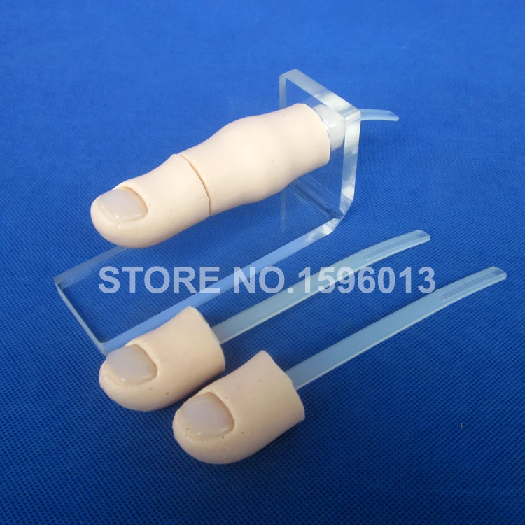 LV6-1 Ingrowing Toenail (1)