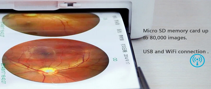 Портативный ручной номера mydriatic дна Камера с FDA
