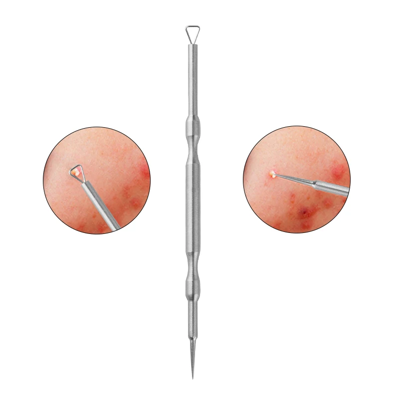 3 шт. Пинцет для удаления угрей набор инструментов черных точек|set brand|tool toolset tools |