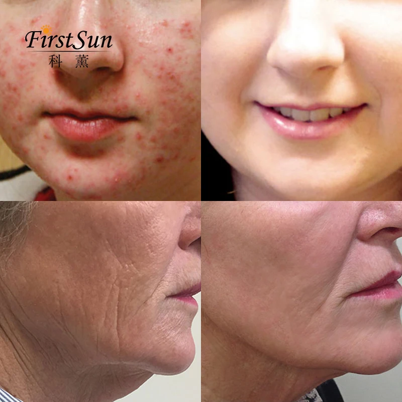 Korean Cosmetic Retinol Vitamin Skin Care Face Lift Essence Anti-Aging Whitening Remove Wrinkle Oil Hyaluronic Acid Serum 2pcs Korean Cosmetic Retinol Vitamin Skin Care Face Lift Essence Anti-Aging Whitening Remove Wrinkle Oil Hyaluronic Acid Serum 2pcs