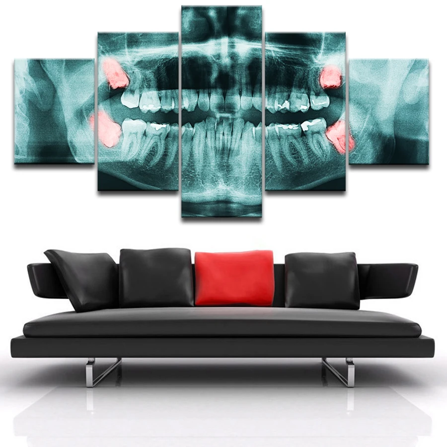 5 шт. холст x-ray of Wisdom Teeth стоматологический Холст Картина декор комнаты печать плакат стены Искусство WD-3056