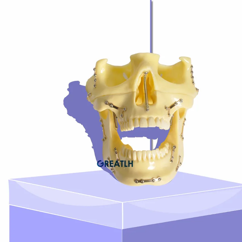 2019 зубные модель якорь винт для имплантата модель для практики
