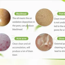 Глубокая, очищающая, черные точки Remover Нос Маска для очищения пор черная маска пилинг акне лечение Черный глубокое очищение для ухода за кожей лица Уход