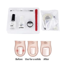 10 шт./компл. вросшие ногти для ног "францзуский маникюр" набор инструментов для коррекции ногтей ног Педикюр эластичная заплатка выпрямление волос Клип Держатель Скоба с резиновыми полосками продается педикюр инструменты