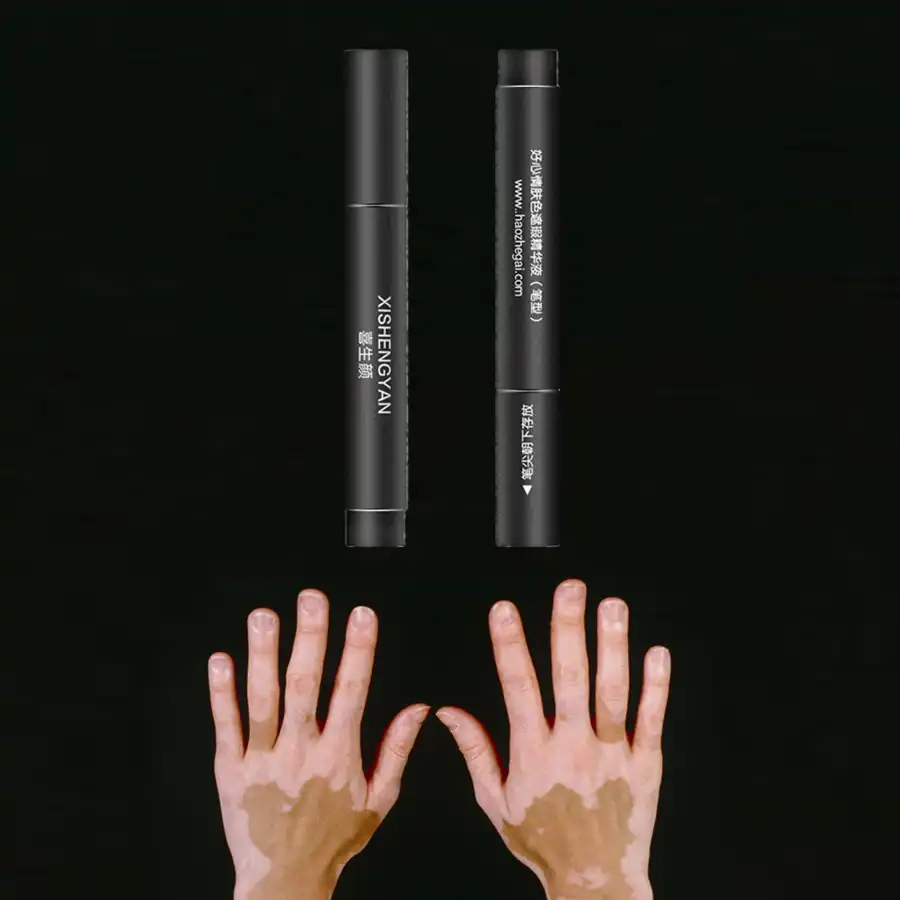 color corrector for vitiligo