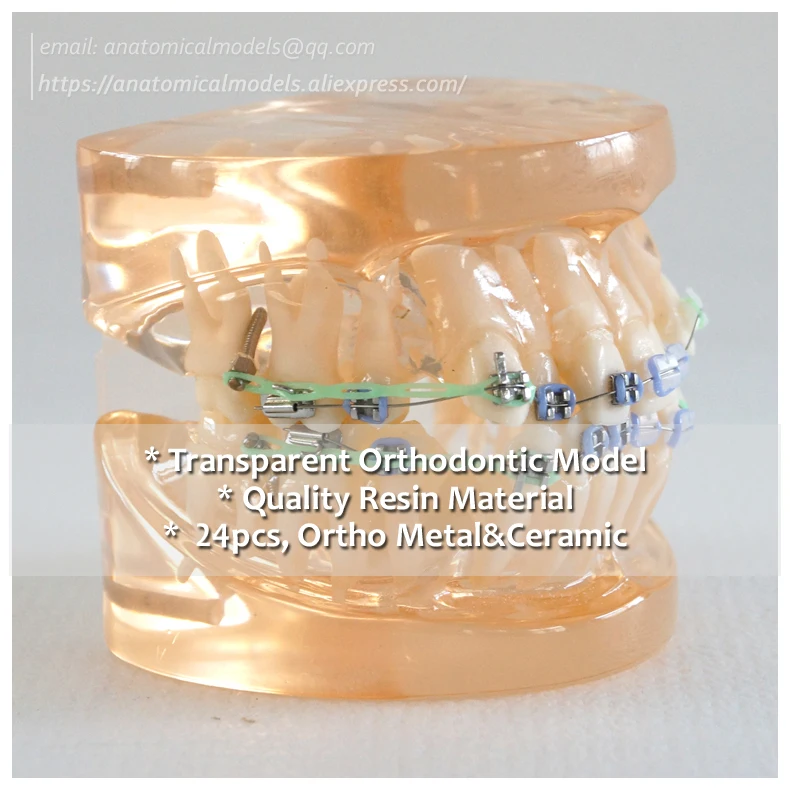 

No.13024, Clear Ortho Metal&Ceramic Dental Model, Dentist Education Oral Dental Ortho Model, China Medical Anatomical Model