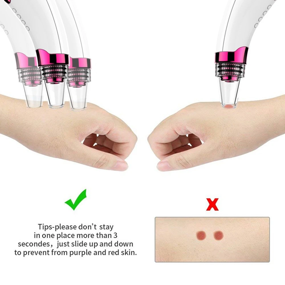Blackhead-Remover (6)