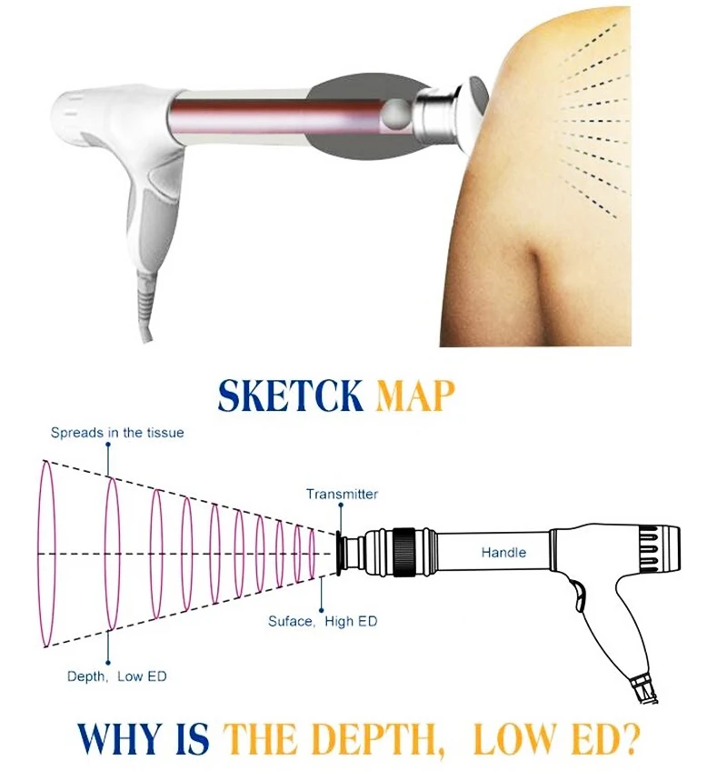 Физическая система боли акустическая Ударная Волна exterorporeal Shockwave машина для боли рельефный питчер 8 бар бесконечные снимки