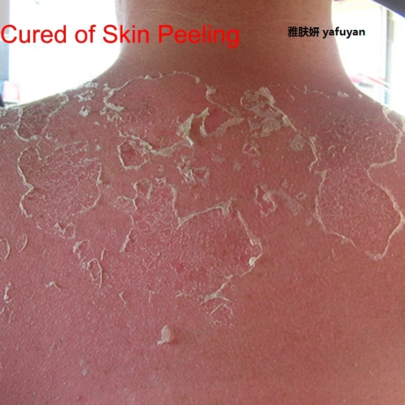 Jual Kosmetik Yafuyan 100G Baku Organik Alami Yang Tidak Dimurnikan Shea Butter Oil Fresh Grade Bergizi Pelembab Kerut Perawatan Kulit