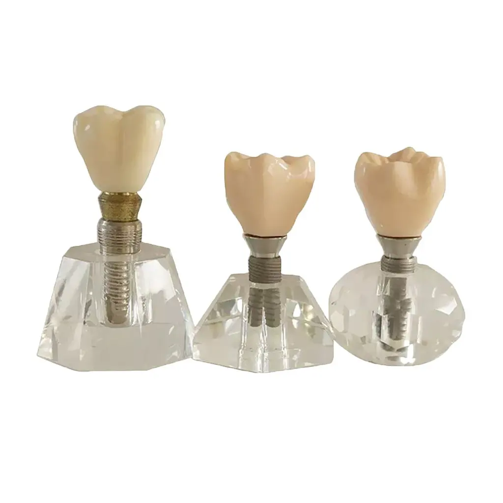 

Teeth Dental Model Basic Structure Patient Educational Equipment Medical Teaching Aid Laboratory Supplies Accessories
