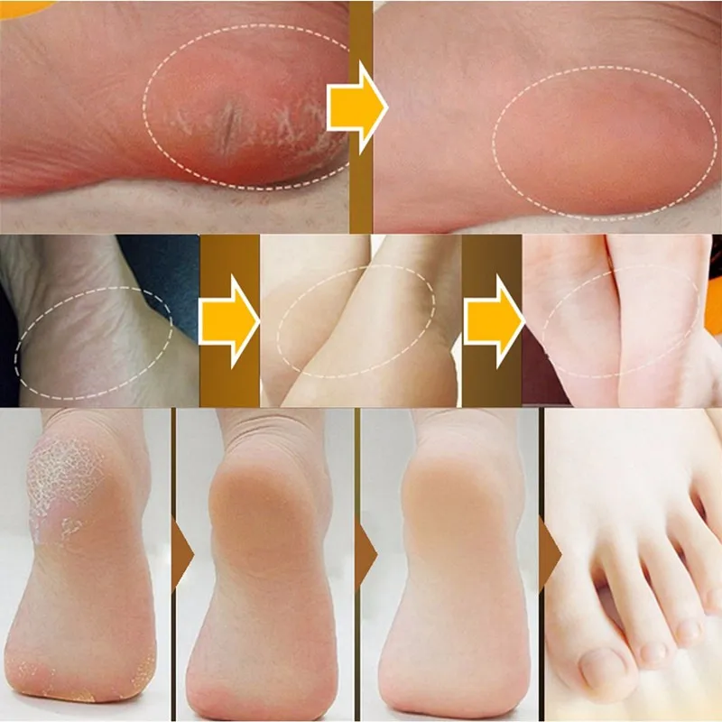 Murah Kaki Perawatan Anti Dry Retak Perbaikan Retak Tumit Anti Inflamasi Kaki Mengupas Balm Exfoliating Foot Cream