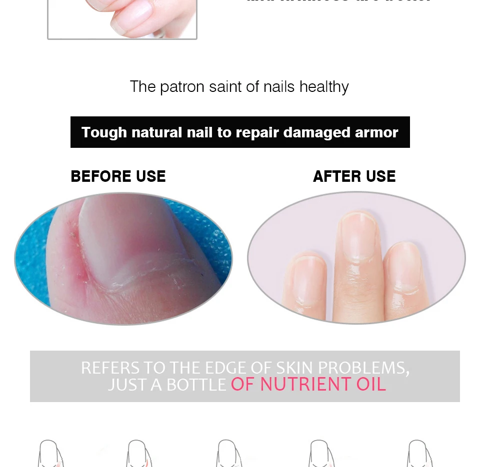 Ruhoya масло для питания ногтей увлажняющий влажный ногтей Новая защита для лечения Женщины Макияж инструменты кутикулы предотвратить питающий кожу инструмент