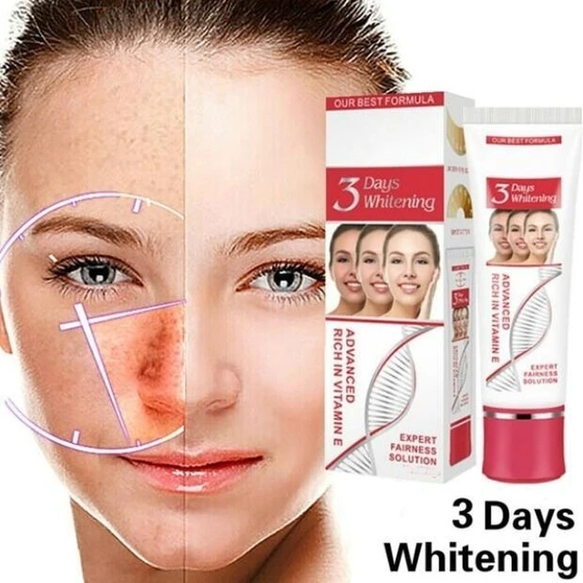 Best skin lightening cream for melasma discount